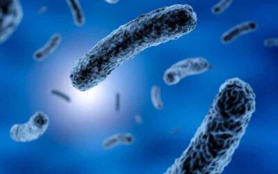 Legionella Kontrol